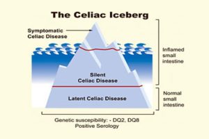 celiac-disease-iceberg
