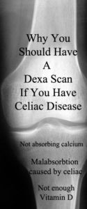 If you have celiac disease you should have a dexa scan- malnutrition can lead to celiac disease