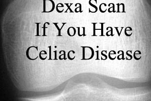 If you have celiac disease you should have a dexa scan- malnutrition can lead to celiac disease