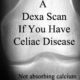 Dexa Scan- Why You Should Get One If You Have Celiac Disease