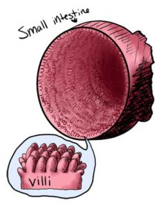 Do you know what Villi or Villus are? This is the part in the intestine that is damaged by gluten if you have celiac